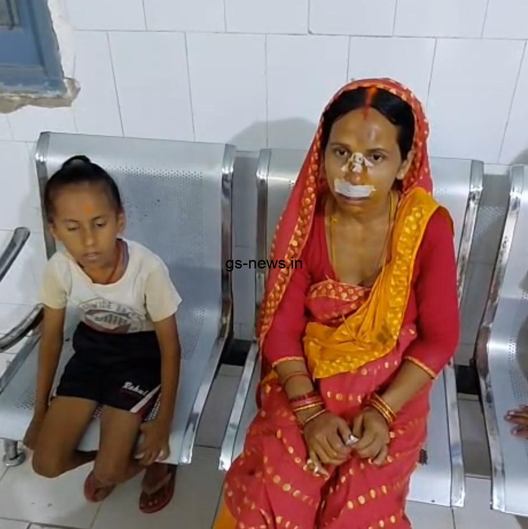 नवगछिया में दिनदहाड़े चेन स्नेचिंग: महिला को धक्का देकर घायल किया, सोने की चेन लूटकर फरार हुए बदमाश